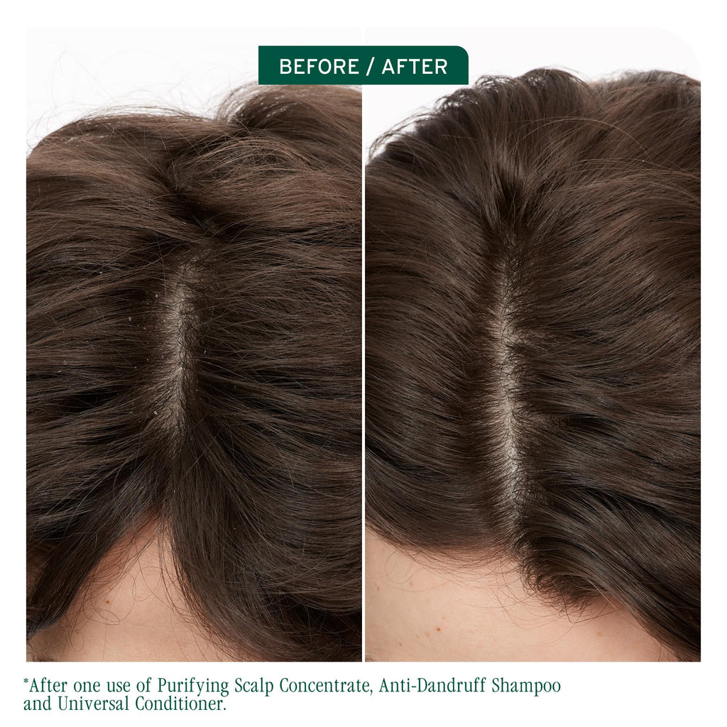 Biolage Scalp Sync Anti-Dandruff Shampoo with Zinc Pyrithione