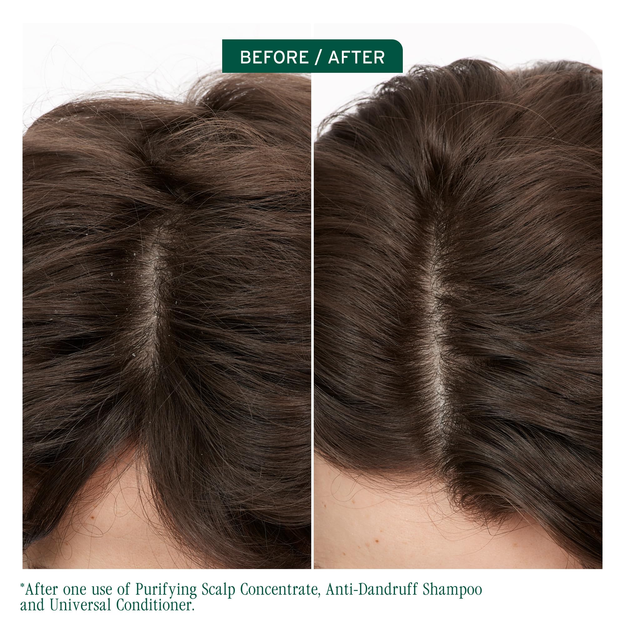 Biolage Scalp Sync Anti-Dandruff Shampoo with Zinc Pyrithione